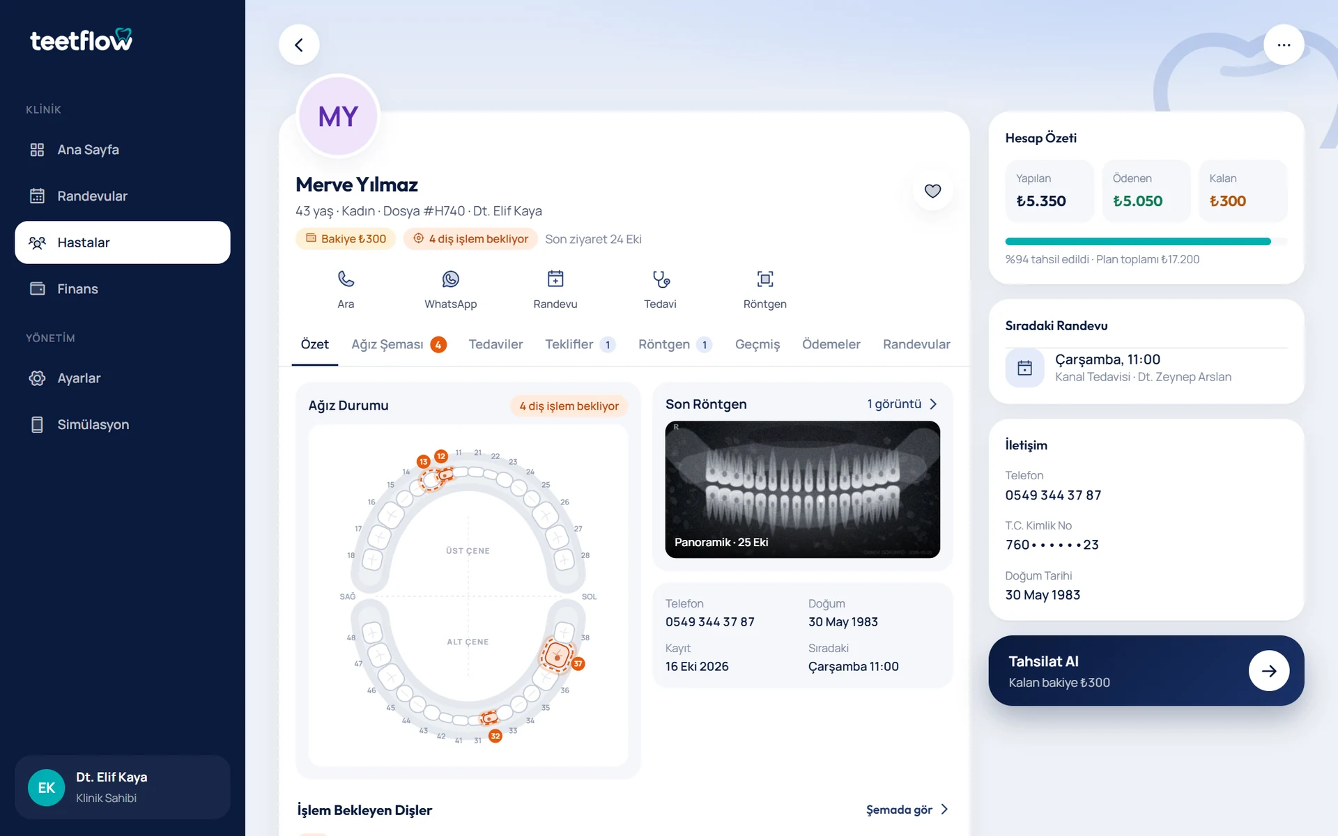 teetflow web paneli — hasta kartı